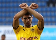 英雄联盟总决赛门票-关于多特蒙德实力暴露短板，需加强补强的信息